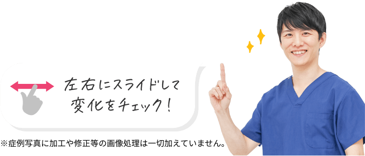 左右にスライドして変化をチェック