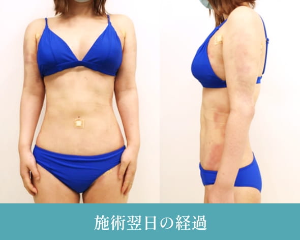 1つ目の理由の画像