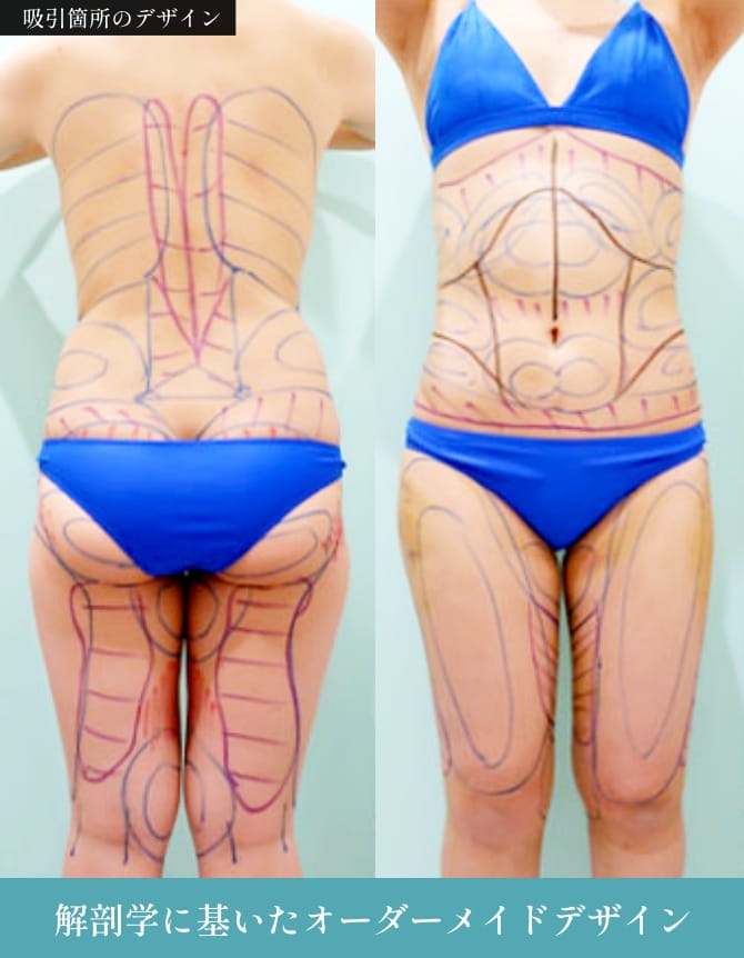 2つ目の理由の画像