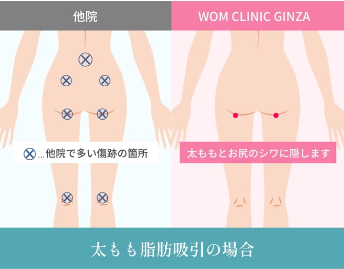 4つ目の理由の画像