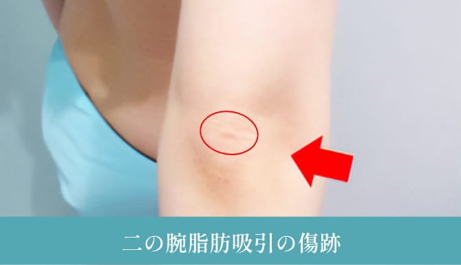 4つ目の理由の画像