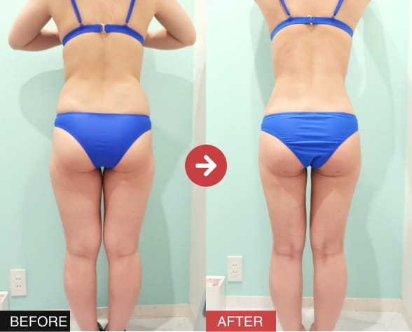 5つ目の理由の画像