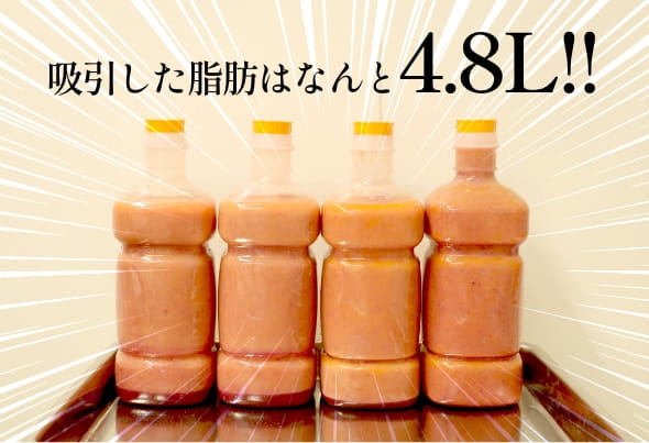 5つ目の理由の画像