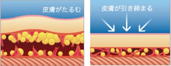 皮膚の引き締め効果があるのが分かる画像