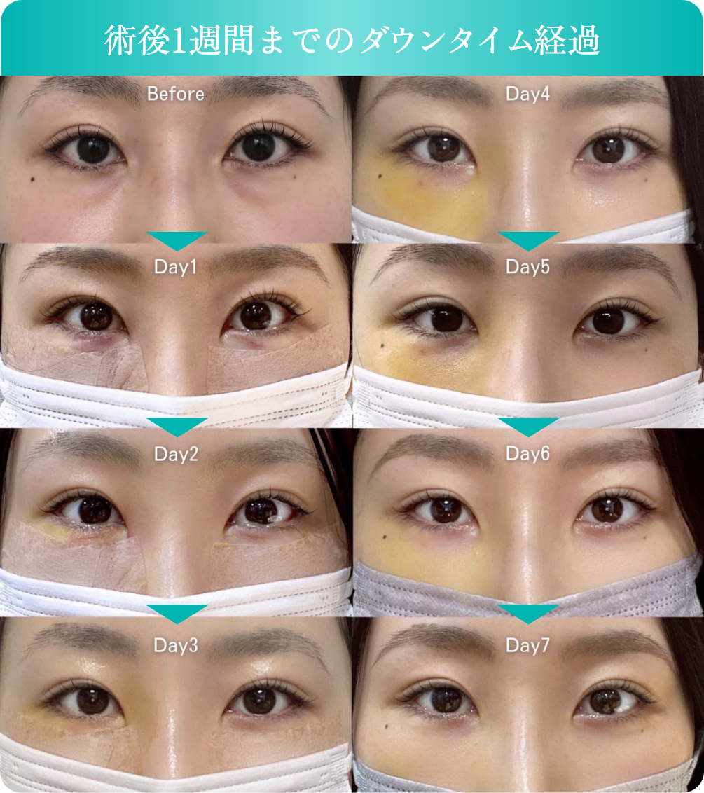 考えられた治療