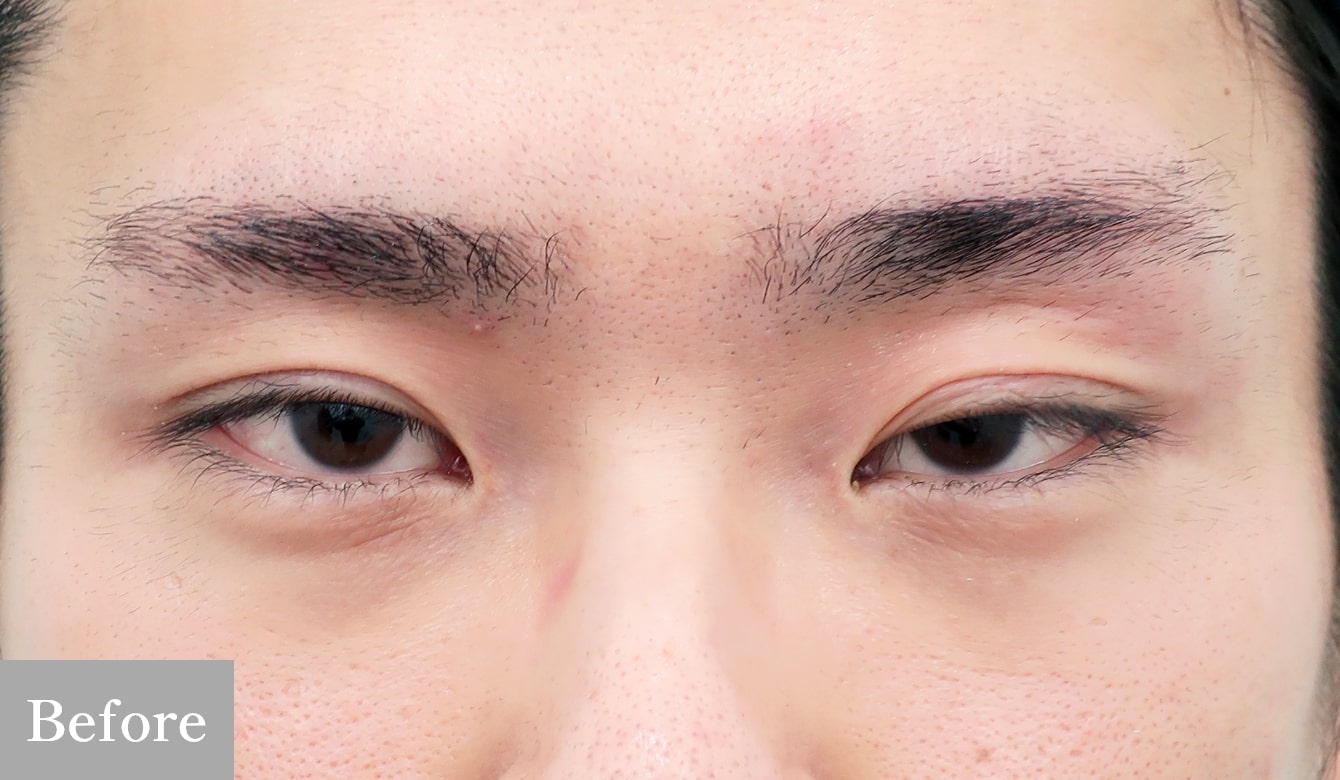 before