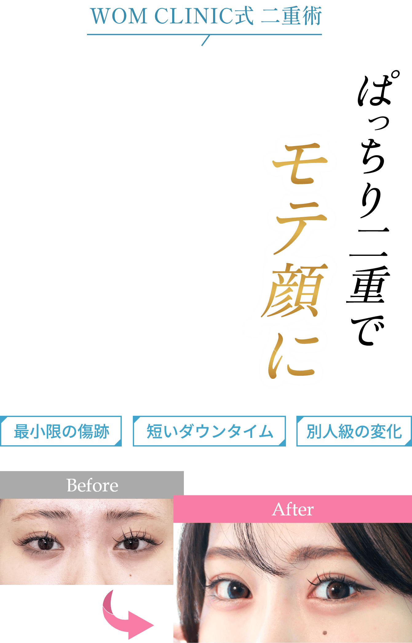 ぱっちり二重でモテ顔に
