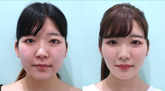 症例写真13