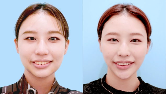 症例写真3