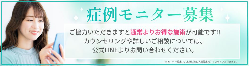 症例モニター募集のお知らせ