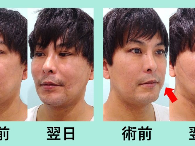 男性 小顔 東京 銀座の美容外科クリニックwom Clinic Ginza