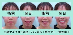 『施術翌日、フェイスライン激変、別人レベルに変化　「小顔組み合わせ治療」』の画像