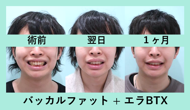 男性 小顔 東京 銀座の美容外科クリニック Wom Clinic Ginza 男性 小顔 東京 銀座の美容外科クリニック Wom Clinic Ginza