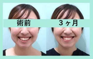 『顔の脂肪再配置 WOM CLINIC ならではの高度な組み合わせ治療』の画像