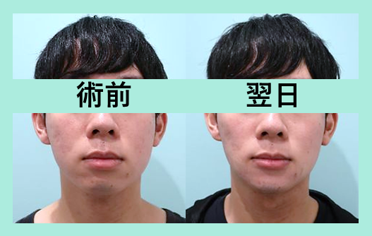 エラボトックス 東京 銀座の美容外科クリニックwom Clinic Ginza Part 3 エラボトックス 東京 銀座の美容外科クリニックwom Clinic Ginza Part 3