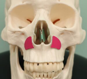 『完全クローズド法で、鼻中隔延長、鼻骨骨切り、貴族手術などのハイテク鼻フル整形』の画像