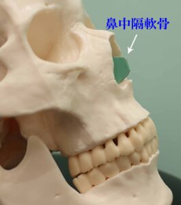 『完全クローズド法で、鼻中隔延長、鼻骨骨切り、貴族手術などのハイテク鼻フル整形』の画像