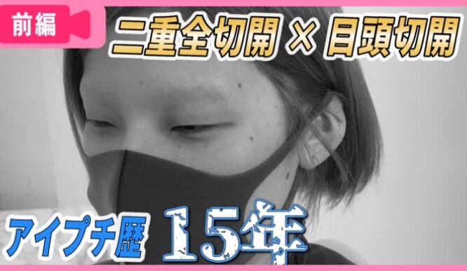 【前編】アイプチ歴15年！たるんだ瞼とおさらば！！