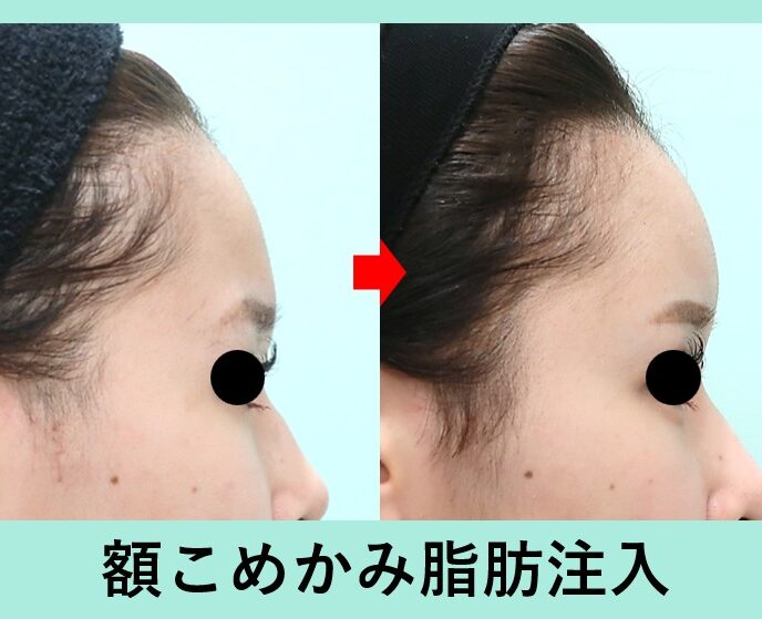 クマ治療の症例参考画像