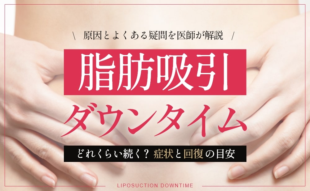 脂肪吸引 ダウンタイム
