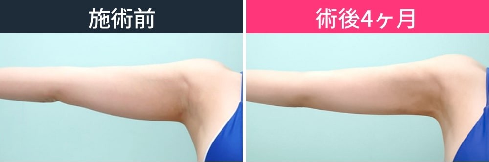 正面からの変化