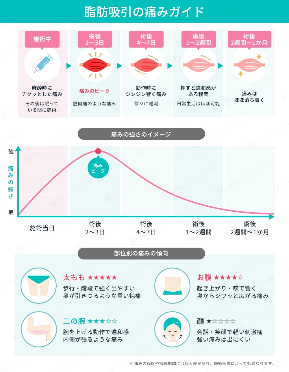 脂肪吸引後の痛みの経過と部位別傾向の図