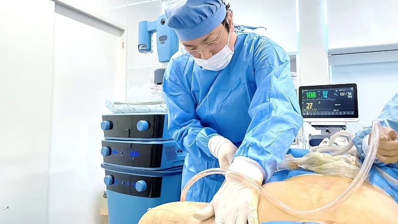 手術中に患者の腹部を処置する外科医