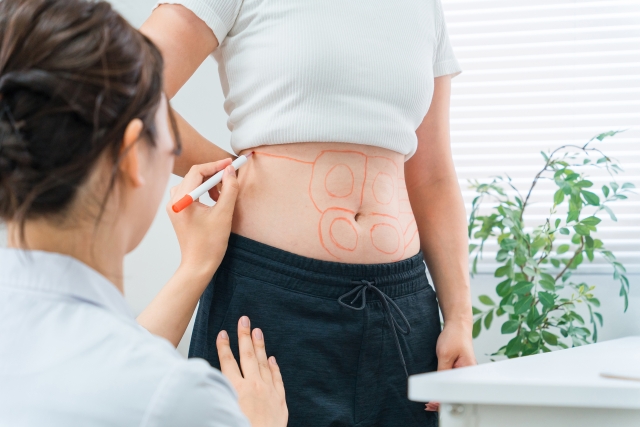 施術前に腹部に印をつける女性医師と患者