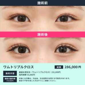 ワムトリプルクロスの症例