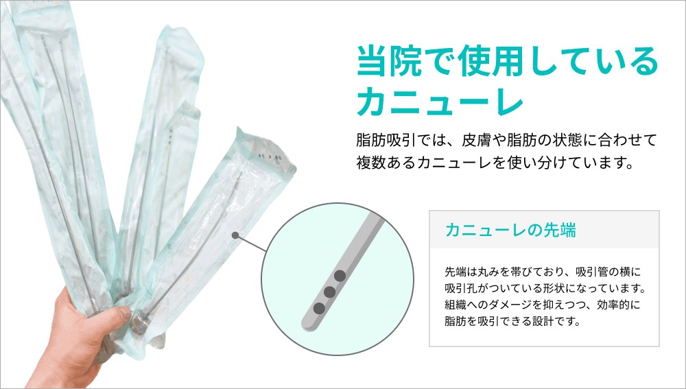 当院で使用しているカニューレの実物と先端イメージイラスト