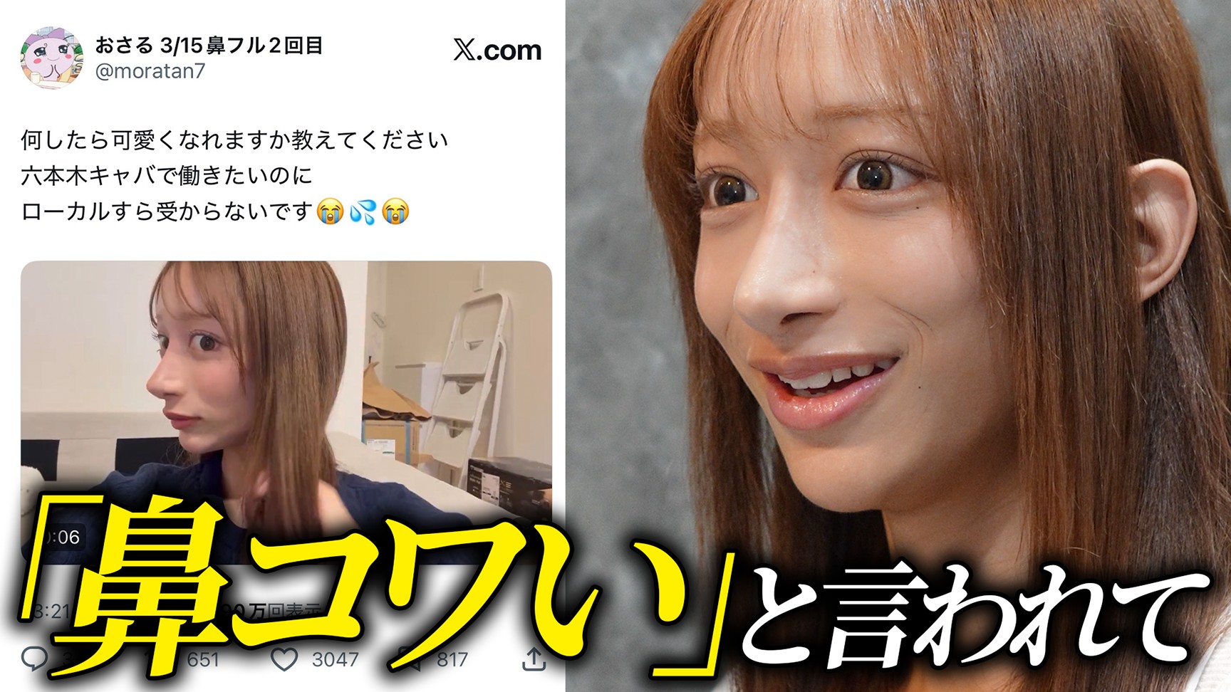 「六本木キャバ嬢になりたい」23歳ニートの鼻修正に密着します