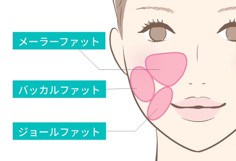 顔の脂肪除去の比較の説明図