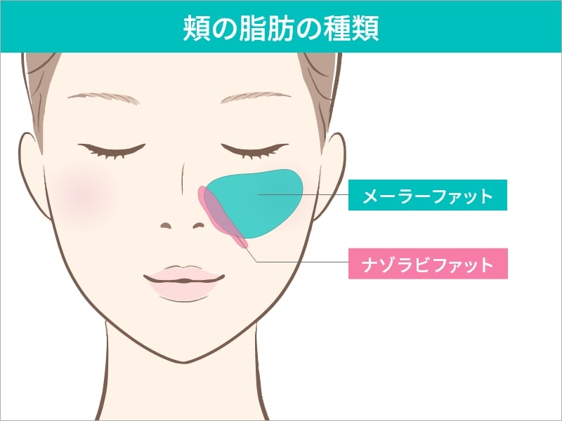 頬の脂肪の種類の説明図