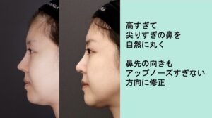 異物除去の症例写真02（横）