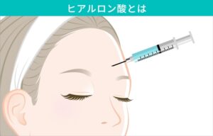 ヒアルロン酸注入とは