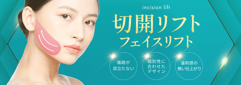フェイスリフト