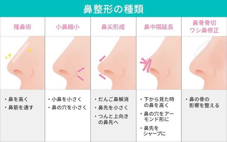 花整形の種類