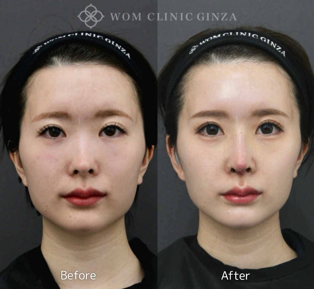 女性の症例写真