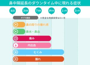 鼻中隔延長のダウンタイム