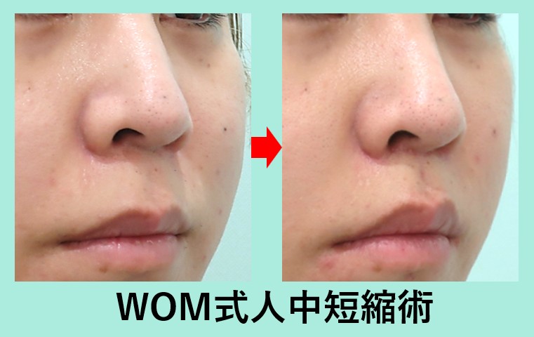 wom式人中短縮