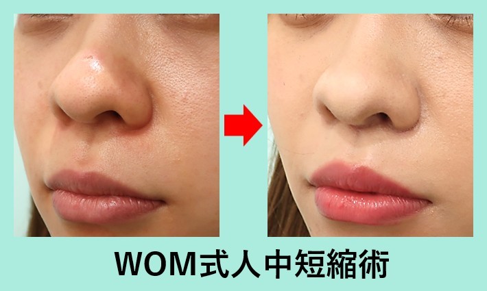 wom式人中短縮