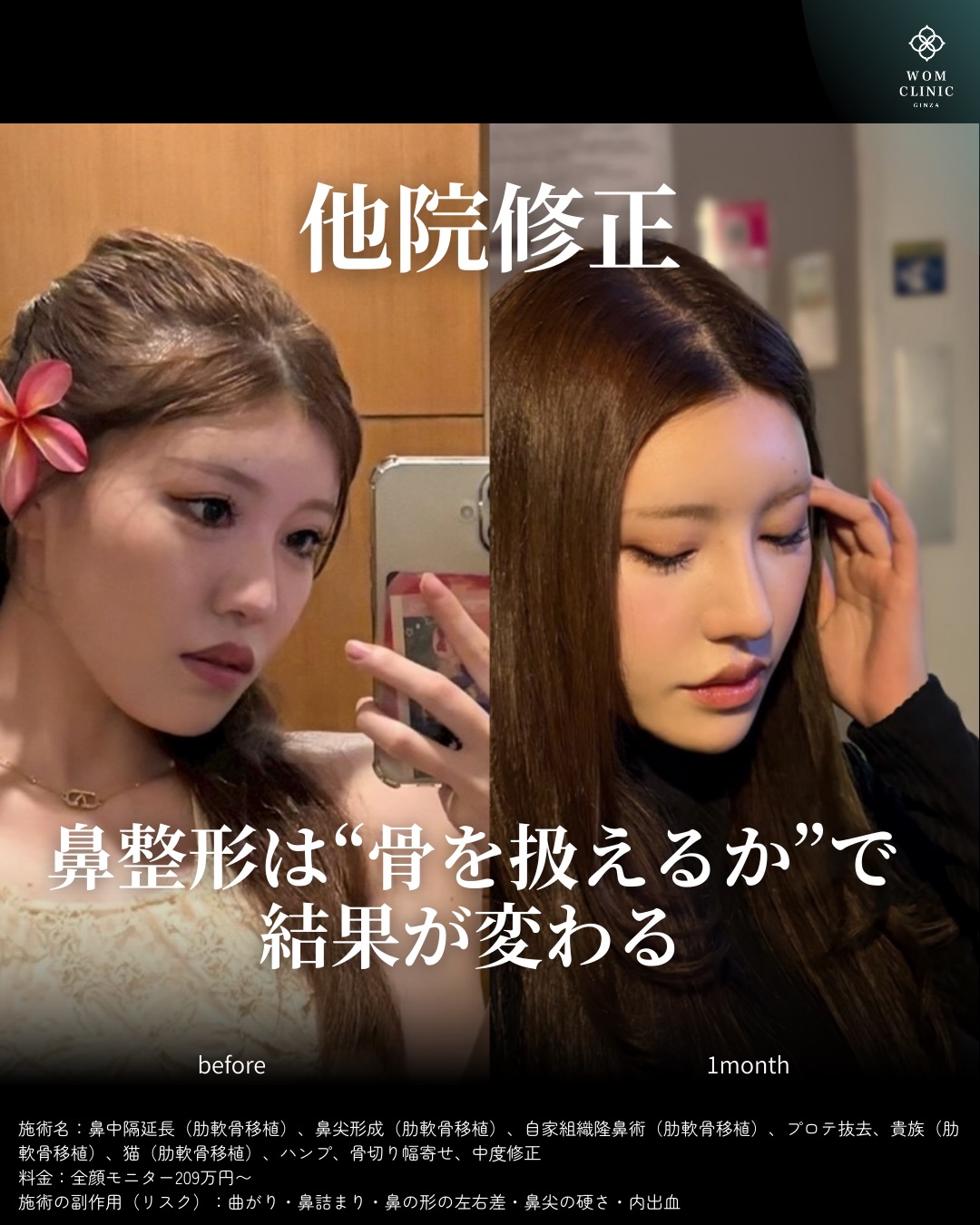 他院修正のビフォーアフター