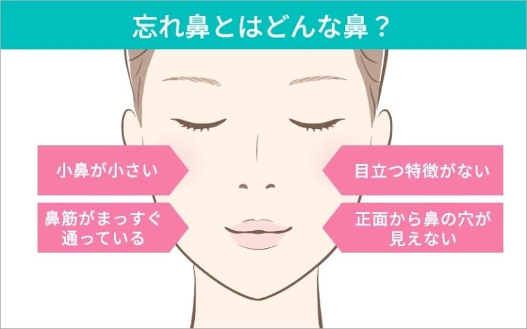 忘れ鼻の説明図