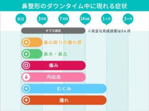 鼻整形のダウンタイム