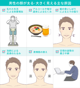 男性の顔が太る・大きく見える主な原因