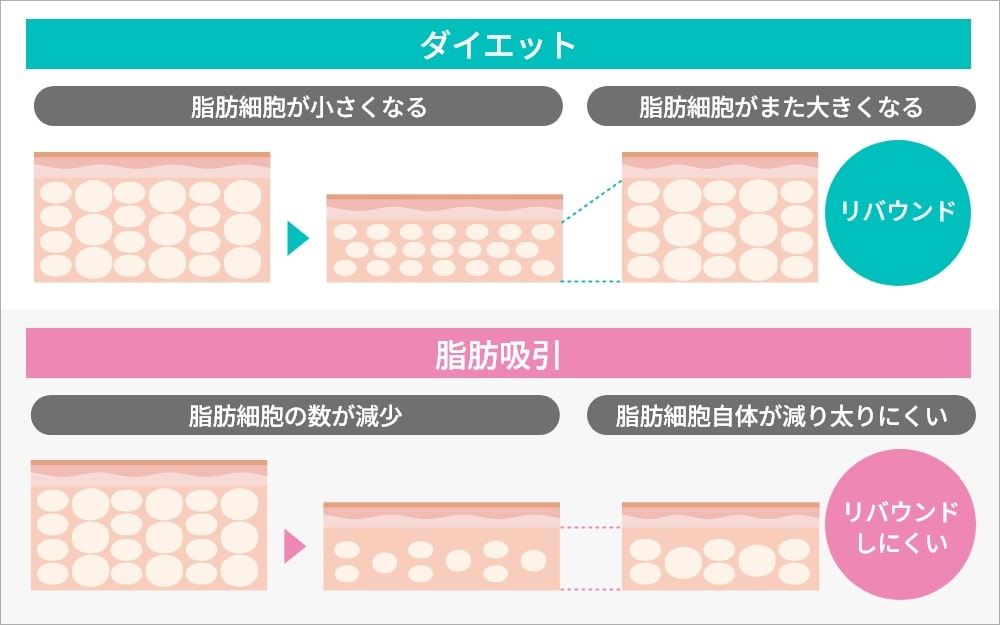 ダイエットと脂肪吸引の違い