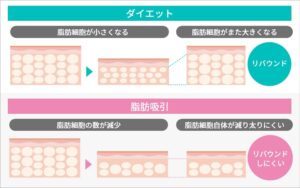 ダイエットと脂肪吸引の違い