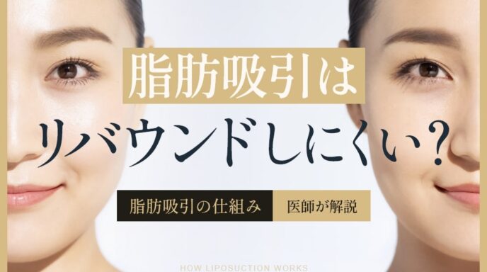 脂肪吸引はリバウンドしにくい？