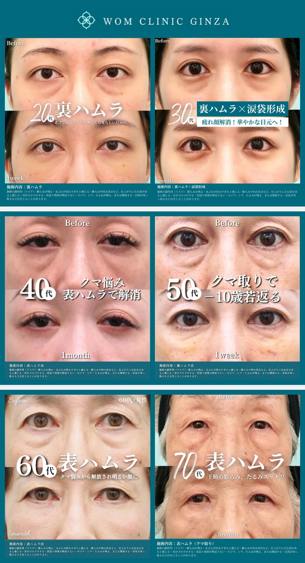 年齢別のクマ治療ビフォーアフター写真