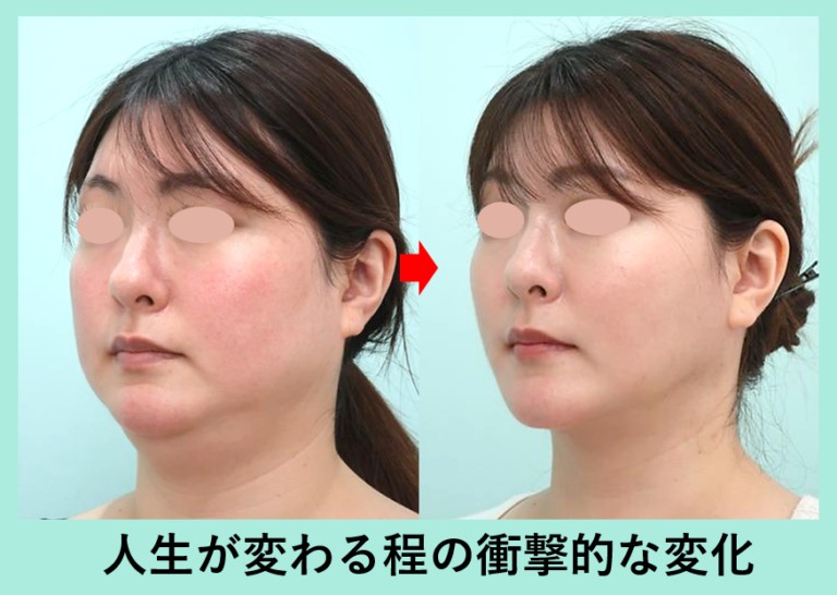 人生が変わる程の衝撃的な変化